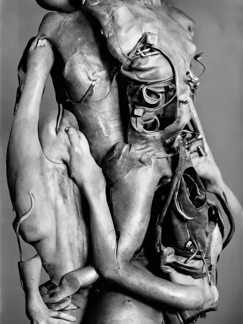 Thoracic Orthosis 01 by Iñigo Bilbao