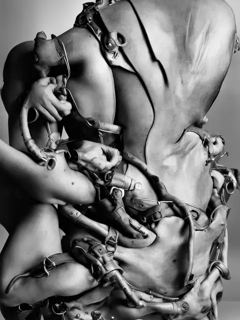 Thoracic Orthosis 03 by Iñigo Bilbao
