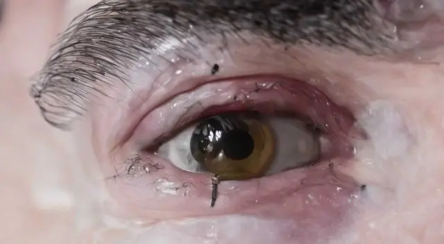 Eye 2 - Ceramics (Milo Poelman) by Milo Poelman